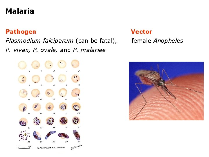 Malaria Pathogen Vector Plasmodium falciparum (can be fatal), female Anopheles P. vivax, P. ovale,