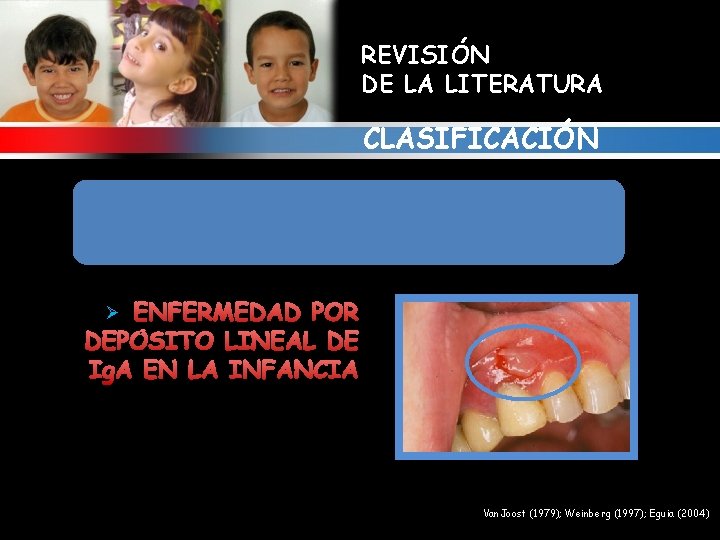 REVISIÓN DE LA LITERATURA CLASIFICACIÓN 1. ALTERACIONES GINGIVALES RELACIONADAS CON ENFERMEDADES MUCOCUTANEAS Y/O INMUNOLOGICAS