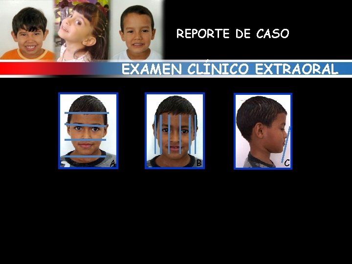 REPORTE DE CASO EXAMEN CLÍNICO EXTRAORAL A B C 