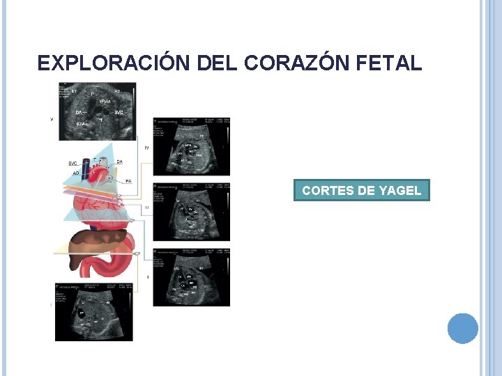 EXPLORACIÓN DEL CORAZÓN FETAL CORTES DE YAGEL EXPLORACIÓN DEL CORAZÓN FETAL CORTES DE YAGEL