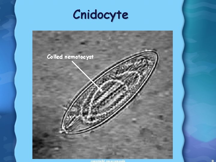 Cnidocyte Coiled nematocyst 