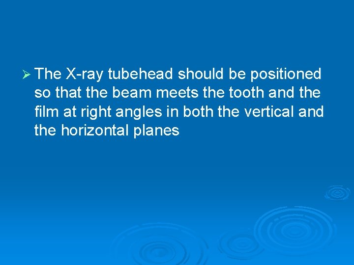 Ø The X-ray tubehead should be positioned so that the beam meets the tooth
