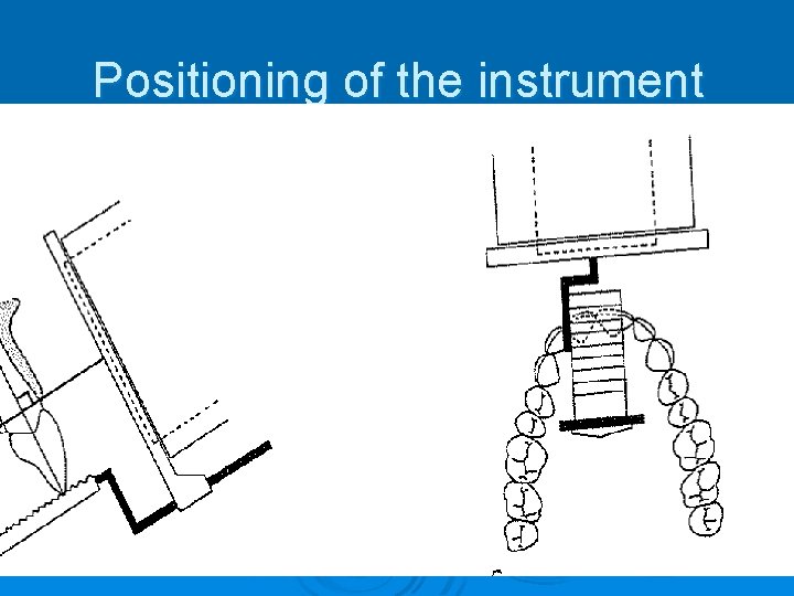 Positioning of the instrument 