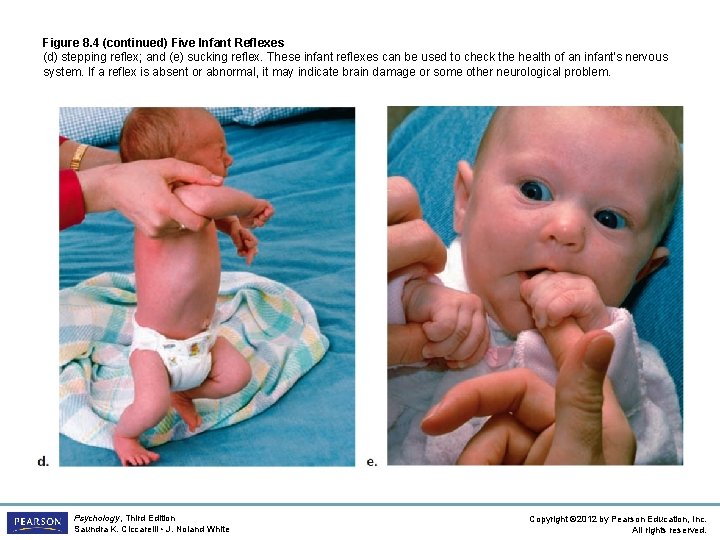 Figure 8. 4 (continued) Five Infant Reflexes (d) stepping reflex; and (e) sucking reflex.