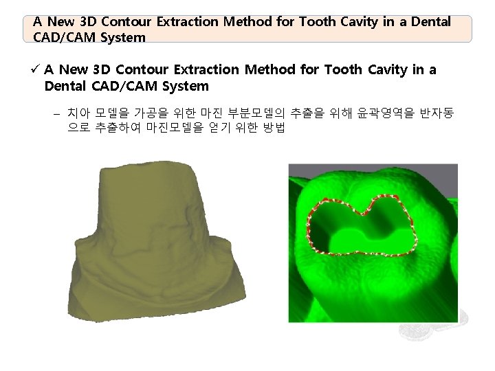 A New 3 D Contour Extraction Method for Tooth Cavity in a Dental CAD/CAM