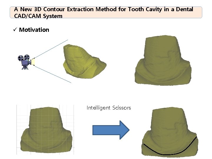 A New 3 D Contour Extraction Method for Tooth Cavity in a Dental CAD/CAM