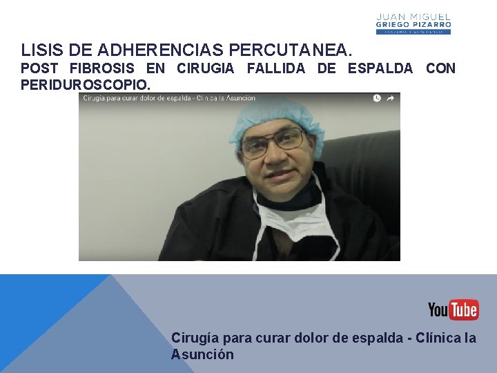 LISIS DE ADHERENCIAS PERCUTANEA. POST FIBROSIS EN CIRUGIA FALLIDA DE ESPALDA CON PERIDUROSCOPIO. Cirugía