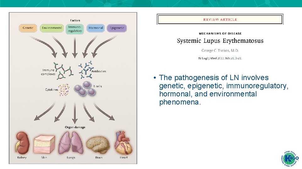 • The pathogenesis of LN involves genetic, epigenetic, immunoregulatory, hormonal, and environmental phenomena. • The pathogenesis of LN involves genetic, epigenetic, immunoregulatory, hormonal, and environmental phenomena.