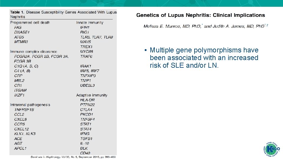 • Multiple gene polymorphisms have been associated with an increased risk of SLE • Multiple gene polymorphisms have been associated with an increased risk of SLE