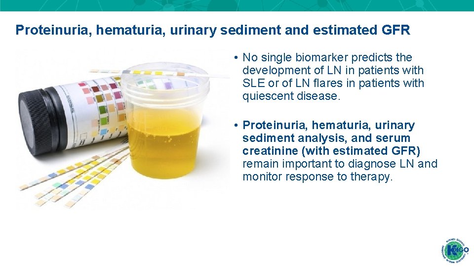 Proteinuria, hematuria, urinary sediment and estimated GFR • No single biomarker predicts the development Proteinuria, hematuria, urinary sediment and estimated GFR • No single biomarker predicts the development