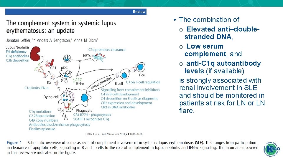 • The combination of o Elevated anti–doublestranded DNA, o Low serum complement, and • The combination of o Elevated anti–doublestranded DNA, o Low serum complement, and