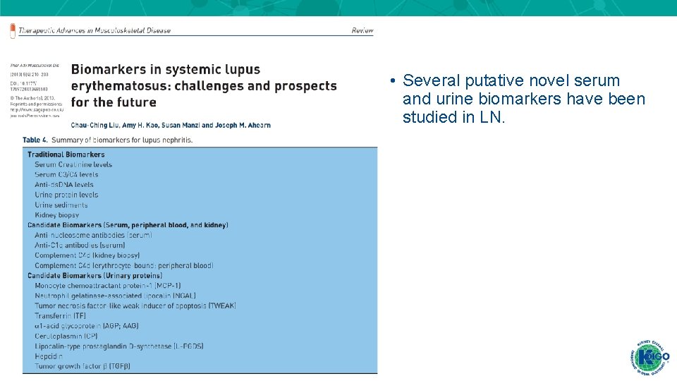 • Several putative novel serum and urine biomarkers have been studied in LN. • Several putative novel serum and urine biomarkers have been studied in LN.