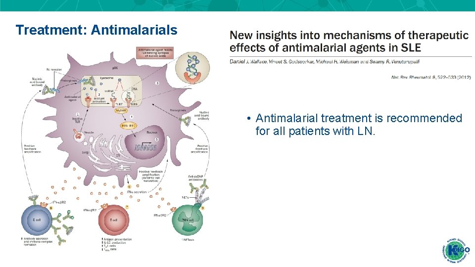Treatment: Antimalarials • Antimalarial treatment is recommended for all patients with LN. Treatment: Antimalarials • Antimalarial treatment is recommended for all patients with LN.