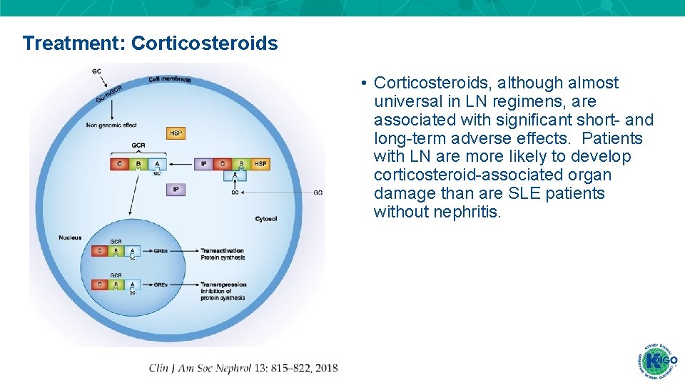 Treatment: Corticosteroids • Corticosteroids, although almost universal in LN regimens, are associated with significant Treatment: Corticosteroids • Corticosteroids, although almost universal in LN regimens, are associated with significant