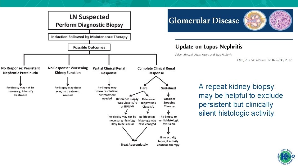 A repeat kidney biopsy may be helpful to exclude persistent but clinically silent histologic A repeat kidney biopsy may be helpful to exclude persistent but clinically silent histologic