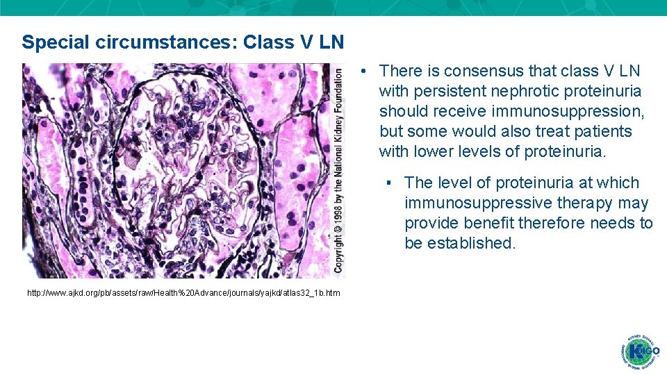 Special circumstances: Class V LN • There is consensus that class V LN with Special circumstances: Class V LN • There is consensus that class V LN with