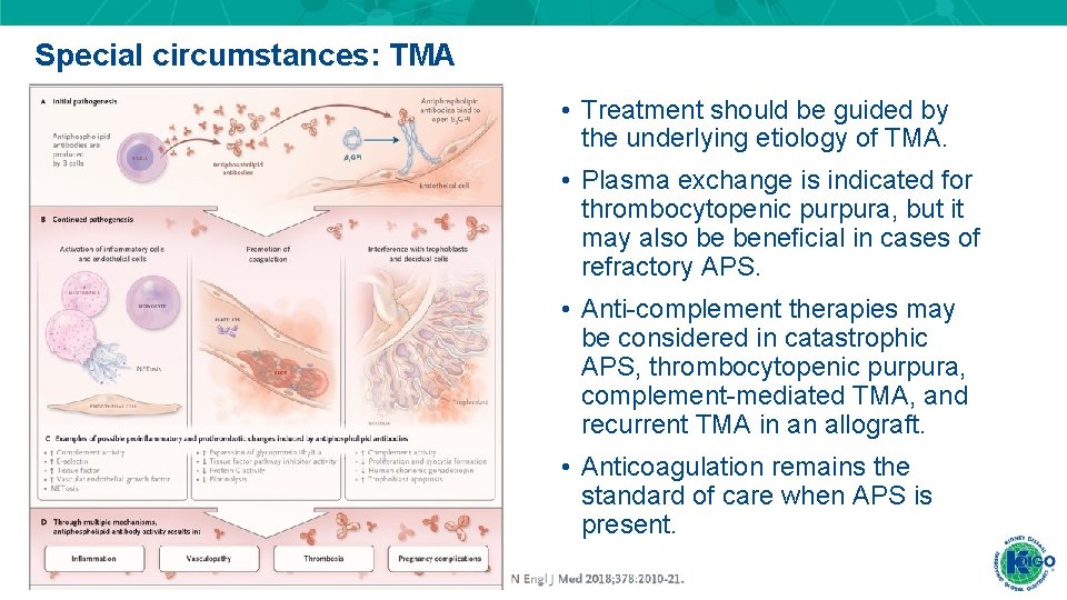 Special circumstances: TMA • Treatment should be guided by the underlying etiology of TMA. Special circumstances: TMA • Treatment should be guided by the underlying etiology of TMA.
