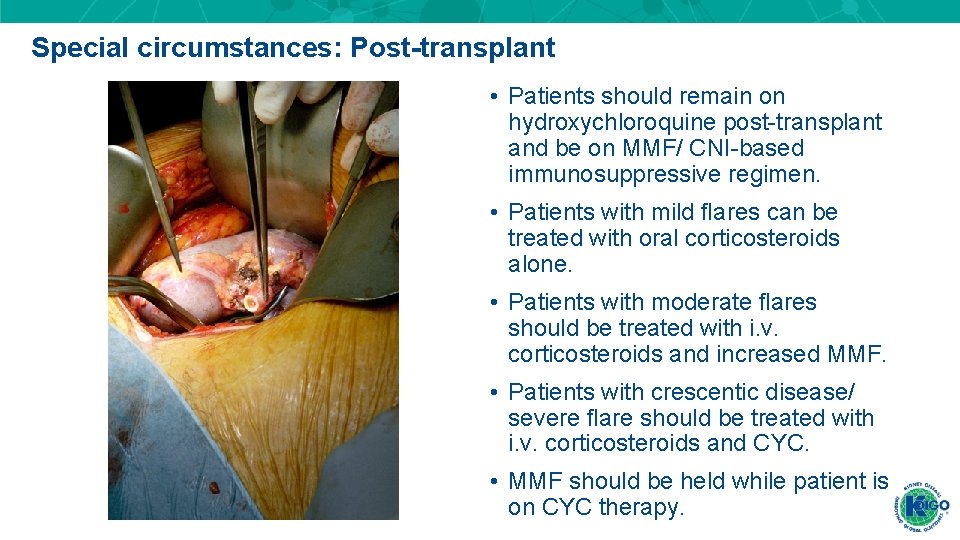 Special circumstances: Post-transplant • Patients should remain on hydroxychloroquine post-transplant and be on MMF/ Special circumstances: Post-transplant • Patients should remain on hydroxychloroquine post-transplant and be on MMF/