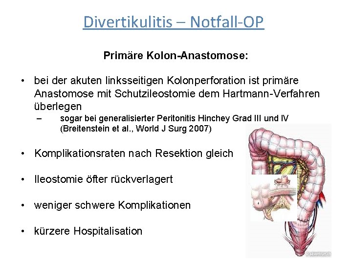 Divertikulitis – Notfall-OP Primäre Kolon-Anastomose: • bei der akuten linksseitigen Kolonperforation ist primäre Anastomose