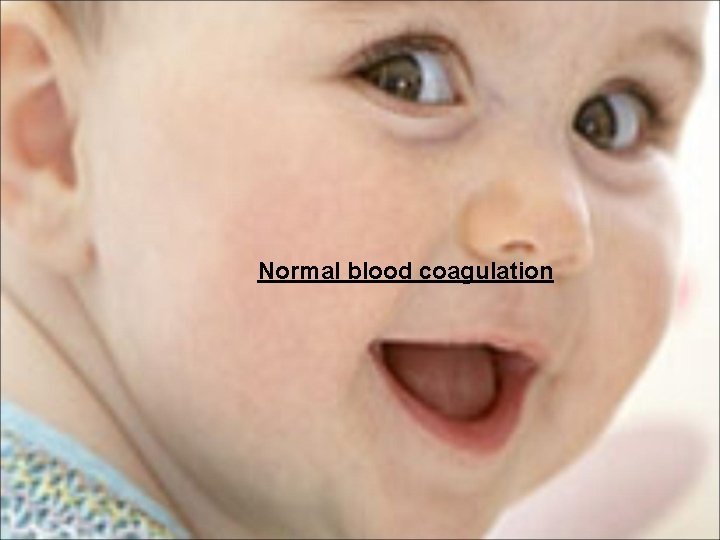 Normal blood coagulation 