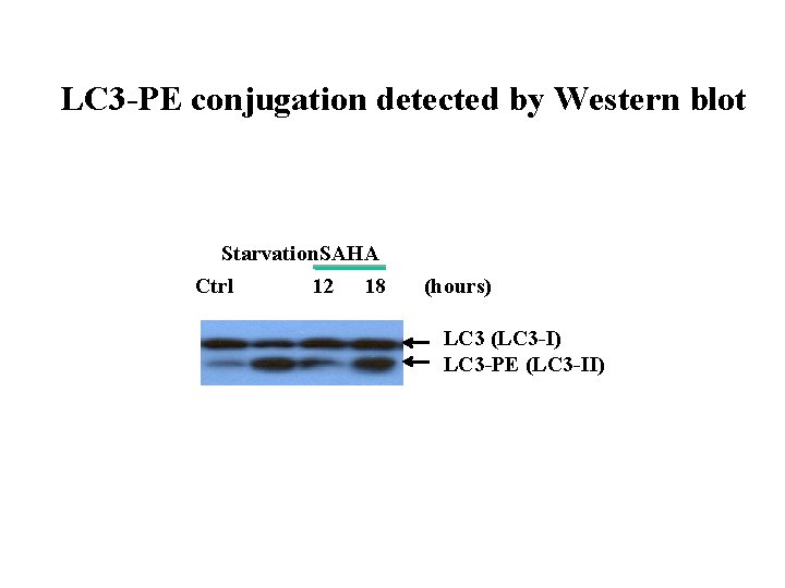 LC 3 -PE conjugation detected by Western blot Starvation. SAHA Ctrl 12 18 (hours)