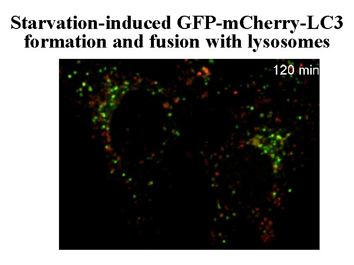 Starvation-induced GFP-m. Cherry-LC 3 formation and fusion with lysosomes 