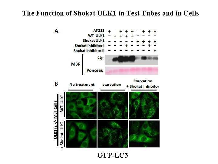 The Function of Shokat ULK 1 in Test Tubes and in Cells GFP-LC 3