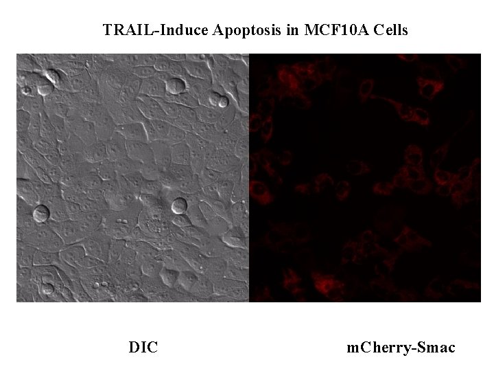 TRAIL-Induce Apoptosis in MCF 10 A Cells DIC m. Cherry-Smac 