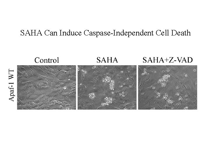 SAHA Can Induce Caspase-Independent Cell Death 