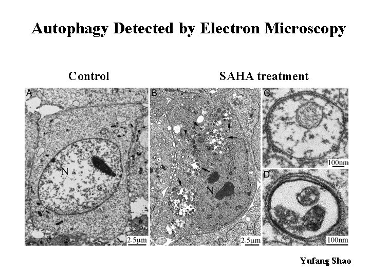 Autophagy Detected by Electron Microscopy Control SAHA treatment Yufang Shao 