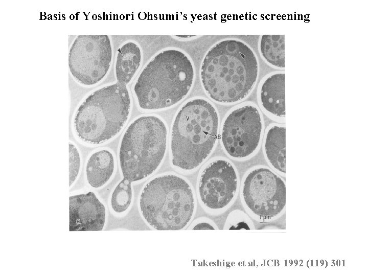 Basis of Yoshinori Ohsumi’s yeast genetic screening Takeshige et al, JCB 1992 (119) 301