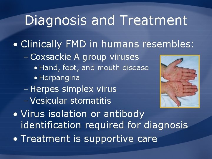 Diagnosis and Treatment • Clinically FMD in humans resembles: – Coxsackie A group viruses