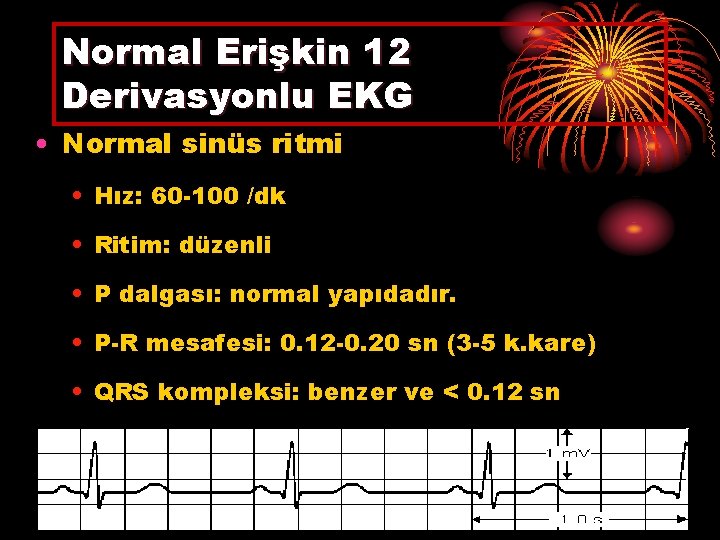 Normal Erişkin 12 Derivasyonlu EKG • Normal sinüs ritmi • Hız: 60 -100 /dk