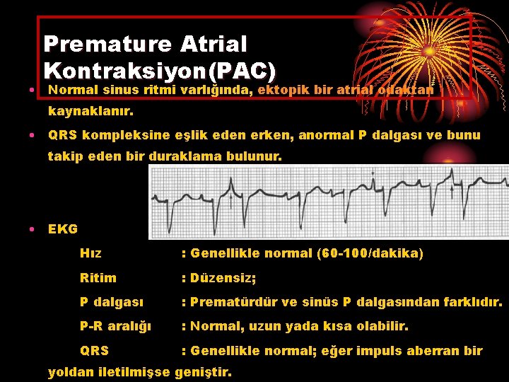 Premature Atrial Kontraksiyon(PAC) • Normal sinus ritmi varlığında, ektopik bir atrial odaktan kaynaklanır. •