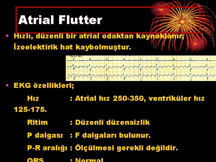Atrial Flutter • Hızlı, düzenli bir atrial odaktan kaynaklanır, İzoelektirik hat kaybolmuştur. • EKG