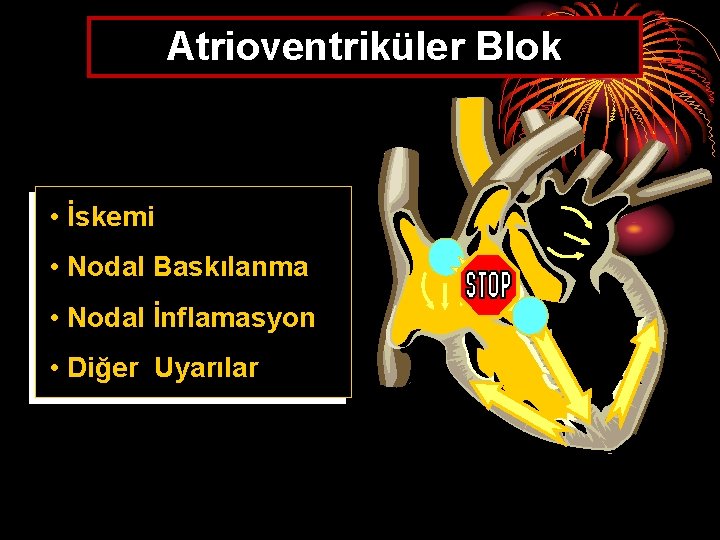 Atrioventriküler Blok • İskemi • Nodal Baskılanma • Nodal İnflamasyon • Diğer Uyarılar 