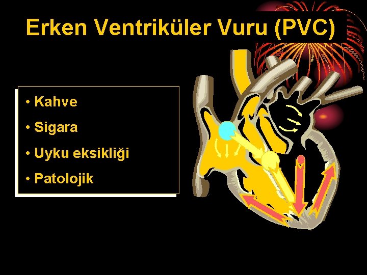 Erken Ventriküler Vuru (PVC) • Kahve • Sigara • Uyku eksikliği • Patolojik 