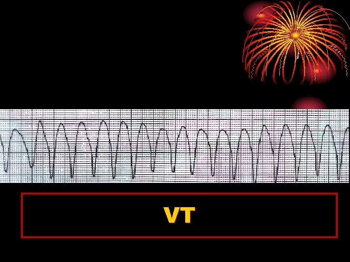 VT 