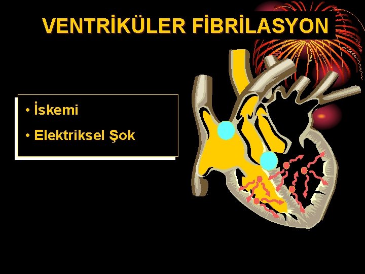 VENTRİKÜLER FİBRİLASYON • İskemi • Elektriksel Şok 