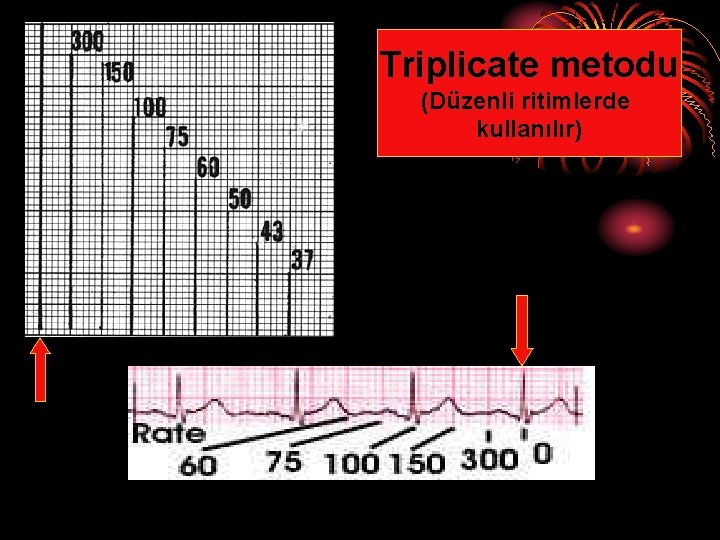 Triplicate metodu (Düzenli ritimlerde kullanılır) 