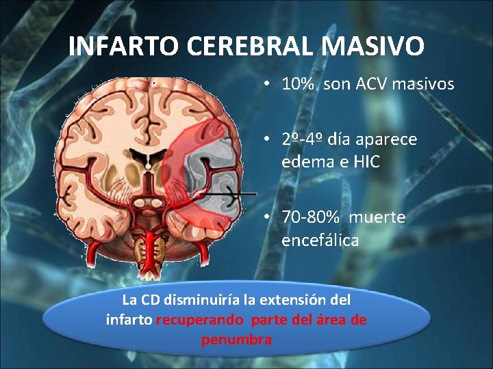 INFARTO CEREBRAL MASIVO • 10% son ACV masivos • 2º-4º día aparece edema e