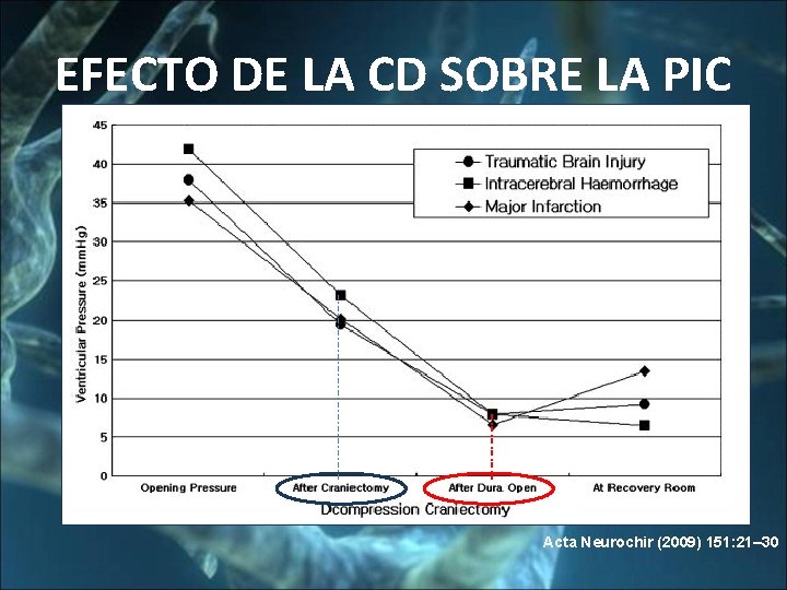 EFECTO DE LA CD SOBRE LA PIC Acta Neurochir (2009) 151: 21– 30 