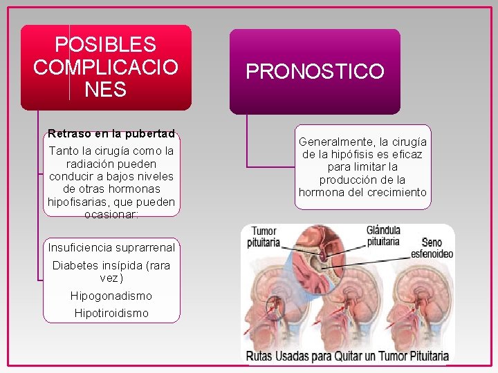 POSIBLES COMPLICACIO NES Retraso en la pubertad Tanto la cirugía como la radiación pueden