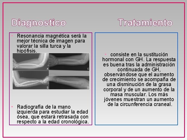 Diagnostico • Resonancia magnética será la mejor técnica de imagen para valorar la silla