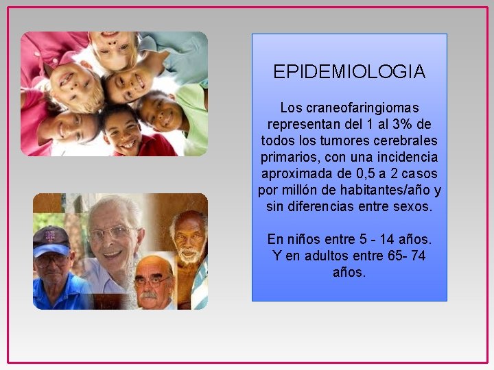 EPIDEMIOLOGIA Los craneofaringiomas representan del 1 al 3% de todos los tumores cerebrales primarios,