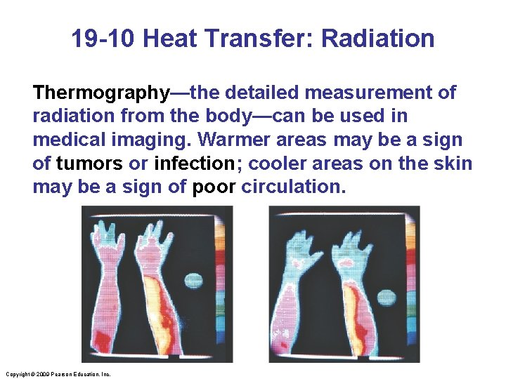 19 -10 Heat Transfer: Radiation Thermography—the detailed measurement of radiation from the body—can be