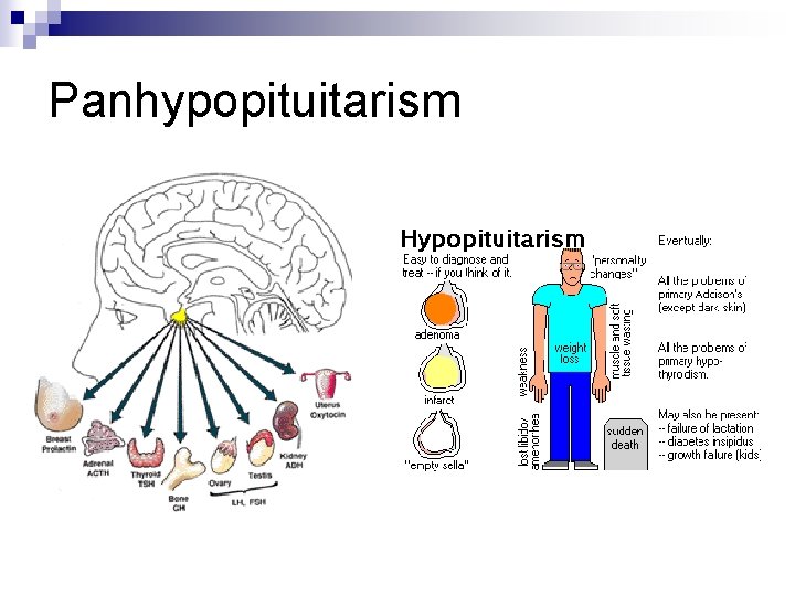 Panhypopituitarism 