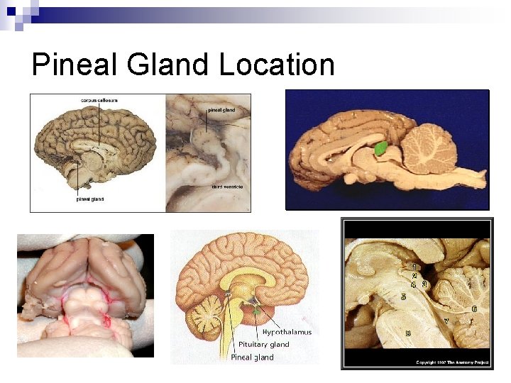 Pineal Gland Location 