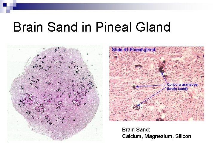 Brain Sand in Pineal Gland Brain Sand: Calcium, Magnesium, Silicon 