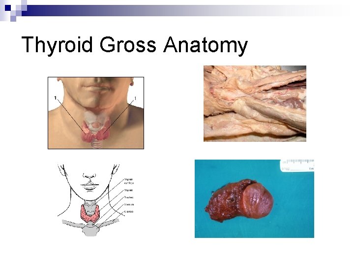 Thyroid Gross Anatomy 